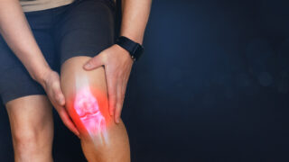 膝関節水腫のすべて:原因から治療、予防まで徹底解説